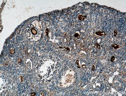 DDX4/VASA Rabbit anti-Human, Mouse, Polyclonal, Proteintech:Antibodies:Primary