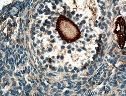 DDX4/VASA Rabbit anti-Human, Mouse, Polyclonal, Proteintech:Antibodies:Primary