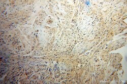 PHF6 Rabbit anti-Human, Mouse, Polyclonal, Proteintech 150 &mu;L; Unconjugated:Antibodies,