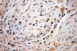 PHF6 Rabbit anti-Human, Mouse, Polyclonal, Proteintech 150 &mu;L; Unconjugated:Antibodies,