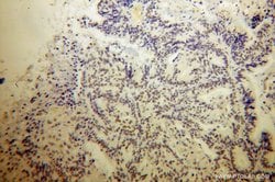 PHF6 Rabbit anti-Human, Mouse, Polyclonal, Proteintech 150 &mu;L; Unconjugated:Antibodies,
