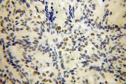 PHF6 Rabbit anti-Human, Mouse, Polyclonal, Proteintech 150 &mu;L; Unconjugated:Antibodies,
