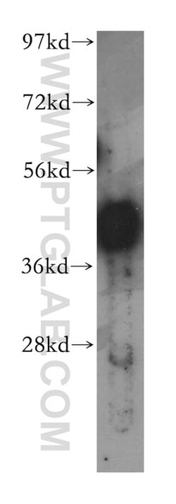 PHF6 Rabbit anti-Human, Mouse, Polyclonal, Proteintech 150 &mu;L; Unconjugated:Antibodies,