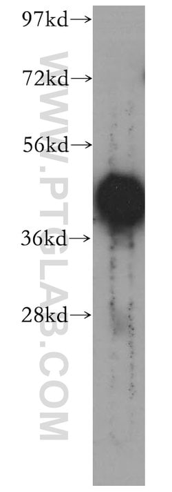 PHF6 Rabbit anti-Human, Mouse, Polyclonal, Proteintech 150 &mu;L; Unconjugated:Antibodies,
