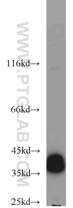 ERK1/2 Rabbit anti-Human, Mouse, Rat, Polyclonal, Proteintech 150 &mu;L;