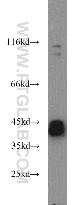 ERK1/2 Rabbit anti-Human, Mouse, Rat, Polyclonal, Proteintech 150 &mu;L;