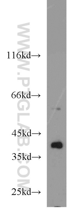 ERK1/2 Rabbit anti-Human, Mouse, Rat, Polyclonal, Proteintech 150 &mu;L;