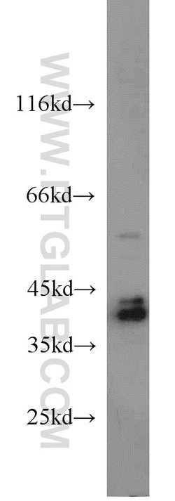 ERK1/2 Rabbit anti-Human, Mouse, Rat, Polyclonal, Proteintech 150 &mu;L;