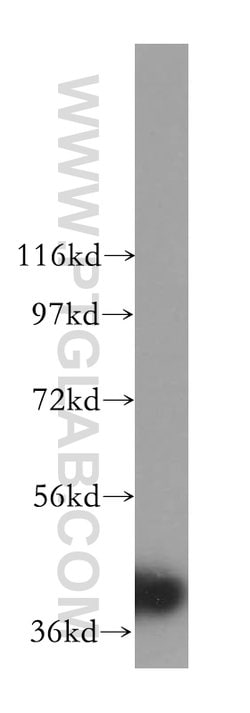 ERK1/2 Rabbit anti-Human, Mouse, Rat, Polyclonal, Proteintech 150 &mu;L;