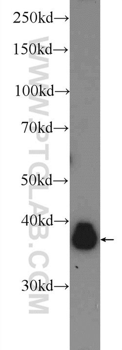 ERK1/2 Rabbit anti-Human, Mouse, Rat, Polyclonal, Proteintech 150 &mu;L;