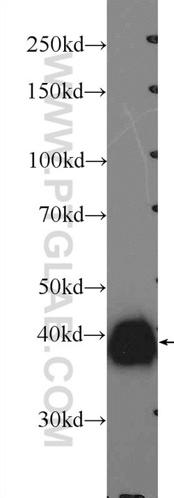 ERK1/2 Rabbit anti-Human, Mouse, Rat, Polyclonal, Proteintech 150 &mu;L;