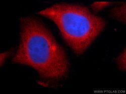 ERK1/2 Rabbit anti-Human, Mouse, Rat, Polyclonal, Proteintech 150 &mu;L;