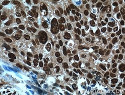 ERK1/2 Rabbit anti-Human, Mouse, Rat, Polyclonal, Proteintech 150 &mu;L;