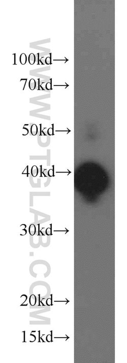 ERK1/2 Rabbit anti-Human, Mouse, Rat, Polyclonal, Proteintech 150 &mu;L;