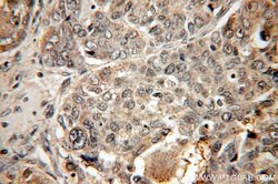 SMAD4 Rabbit anti-Human, Mouse, Polyclonal, Proteintech 150 &mu;L; Unconjugated:Antibodies,