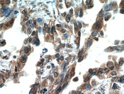 SMAD4 Rabbit anti-Human, Mouse, Polyclonal, Proteintech 150 &mu;L; Unconjugated:Antibodies,