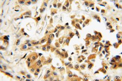 SMAD4 Rabbit anti-Human, Mouse, Polyclonal, Proteintech 150 &mu;L; Unconjugated:Antibodies,