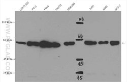 SMAD4 Rabbit anti-Human, Mouse, Polyclonal, Proteintech 150 &mu;L; Unconjugated:Antibodies,