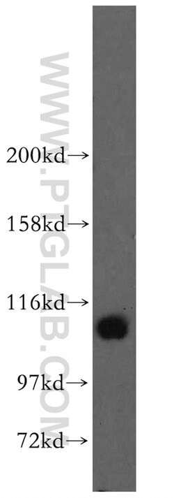 STAT6 Rabbit anti-Human, Mouse, Rat, Polyclonal, Proteintech 150 &mu;L;