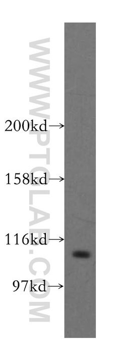 STAT6 Rabbit anti-Human, Mouse, Rat, Polyclonal, Proteintech 150 &mu;L;