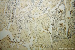 STAT5A Rabbit anti-Human, Mouse, Polyclonal, Proteintech 150 &mu;L | Buy Online | Proteintech Group Inc | Fisher Scientific