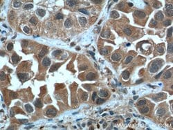 STAT3 Rabbit anti-Human, Mouse, Polyclonal, Proteintech:Antibodies:Primary