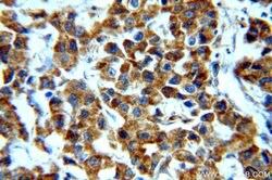 STAT3 Rabbit anti-Human, Mouse, Polyclonal, Proteintech:Antibodies:Primary