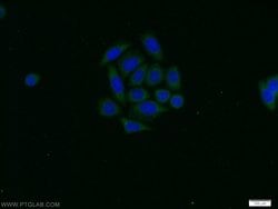 PAK1 Rabbit anti-Human, Polyclonal, Proteintech 150 &mu;L | Buy Online | Proteintech Group Inc | Fisher Scientific
