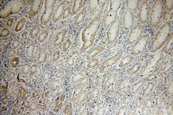 PAK1 Rabbit anti-Human, Polyclonal, Proteintech 150 &mu;L | Buy Online | Proteintech Group Inc | Fisher Scientific