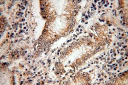 PAK1 Rabbit anti-Human, Polyclonal, Proteintech 150 &mu;L | Buy Online | Proteintech Group Inc | Fisher Scientific