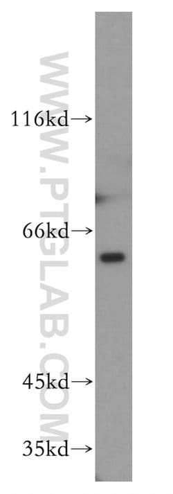 PAK1 Rabbit anti-Human, Polyclonal, Proteintech 150 &mu;L | Buy Online | Proteintech Group Inc | Fisher Scientific