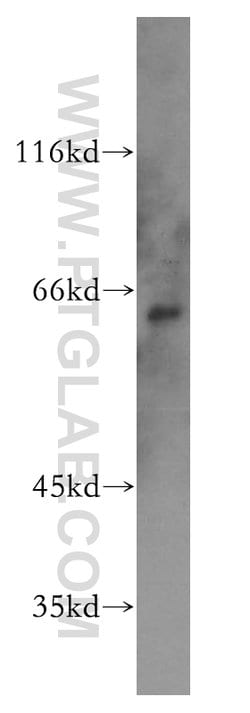 PAK1 Rabbit anti-Human, Polyclonal, Proteintech 150 &mu;L | Buy Online | Proteintech Group Inc | Fisher Scientific