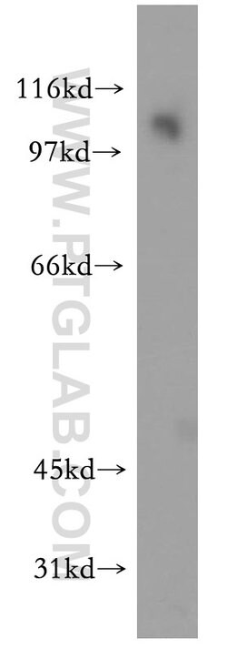 PPP1R13L Rabbit anti-Human, Mouse, Polyclonal, Proteintech 150 &mu;L | Buy Online | Proteintech | Fisher Scientific