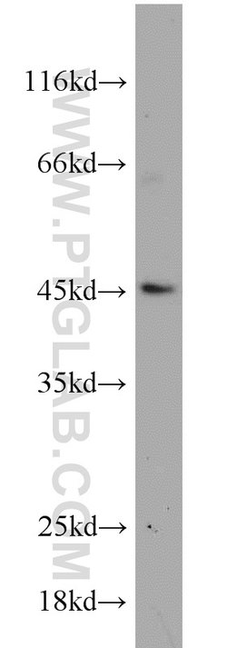 MEK4 Rabbit anti-Human, Mouse, Polyclonal, Proteintech 20 &mu;L; Unconjugated:Anticorps,