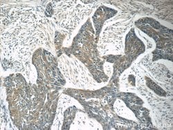 TMPRSS3 Rabbit anti-Human, Mouse, Polyclonal, Proteintech