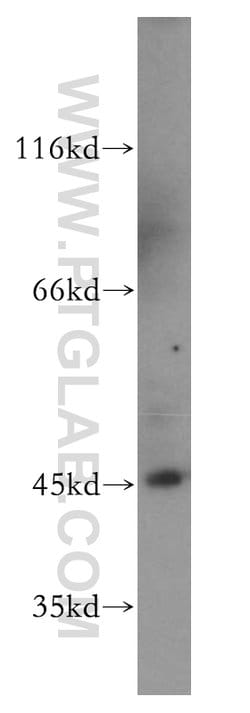 JNK Rabbit anti-Human, Mouse, Polyclonal, Proteintech 150 &mu;L; Unconjugated:Antibodies,