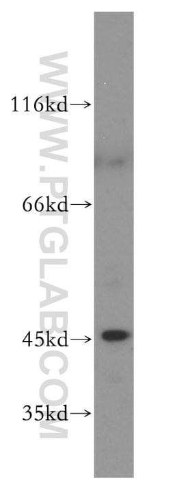 JNK Rabbit anti-Human, Mouse, Polyclonal, Proteintech 150 &mu;L; Unconjugated:Antibodies,