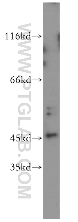 JNK Rabbit anti-Human, Mouse, Polyclonal, Proteintech 150 &mu;L; Unconjugated:Antibodies,