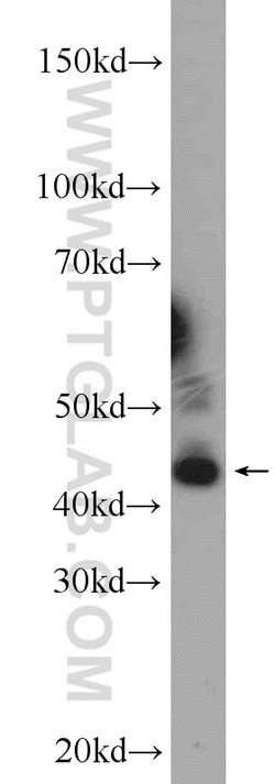 JNK Rabbit anti-Human, Mouse, Polyclonal, Proteintech 150 &mu;L; Unconjugated:Antibodies,