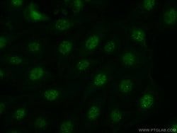 JNK Rabbit anti-Human, Mouse, Polyclonal, Proteintech 150 &mu;L; Unconjugated:Antibodies,