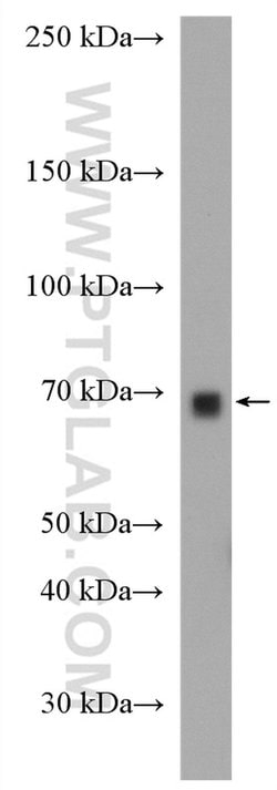 Cyp4a12a Rabbit anti-Mouse, Rat, Polyclonal, Proteintech 20 &mu;L; Unconjugated:Anticuerpos