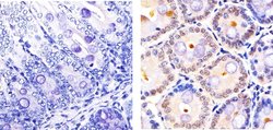 Invitrogen Cullin 2 Polyclonal Antibody 100 &mu;g; Unconjugated:Antibodies,