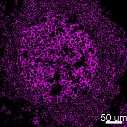 CD20 Monoclonal Antibody (L26), Alexa Fluor 488, eBioscience , Invitrogen:Antibodies:Primary