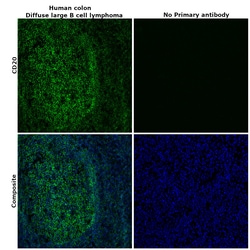 CD20 Monoclonal Antibody (L26), Alexa Fluor 488, eBioscience , Invitrogen:Antibodies:Primary