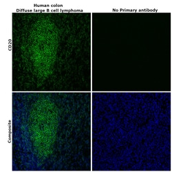 CD20 Monoclonal Antibody (L26), Alexa Fluor 488, eBioscience , Invitrogen:Antibodies:Primary