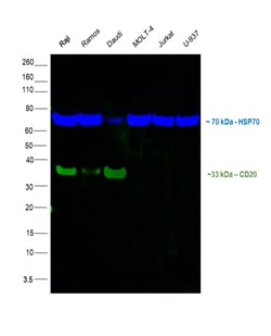 CD20 Monoclonal Antibody (L26), Alexa Fluor 488, eBioscience , Invitrogen:Antibodies:Primary