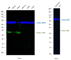 CD20 Monoclonal Antibody (L26), Alexa Fluor 488, eBioscience , Invitrogen:Antibodies:Primary