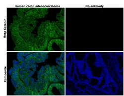 Invitrogen beta Catenin Monoclonal Antibody (15B8), Alexa Fluor 488, eBioscience