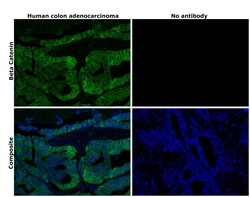Invitrogen beta Catenin Monoclonal Antibody (15B8), Alexa Fluor 488, eBioscience