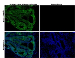 Invitrogen beta Catenin Monoclonal Antibody (15B8), Alexa Fluor 488, eBioscience